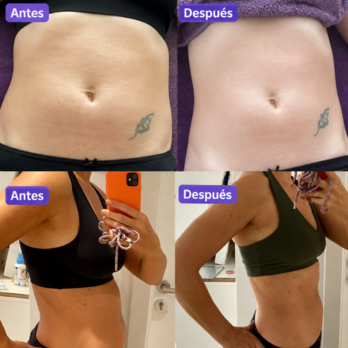 ADDWIN Fascia Device™